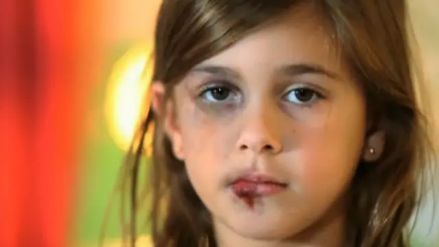 अमरीका, बाल शोषण, दुर्व्यवहार, बाल मृत्यु, टेक्सस, ह्यूस्टन