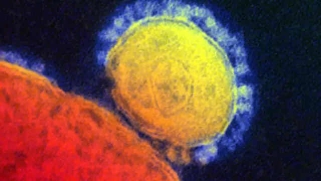 كان باحثون قد اشاروا في اغسطس / آب الماضي الى احتمال ان تلعب الجمال العربية دور الحاضن للفيروس