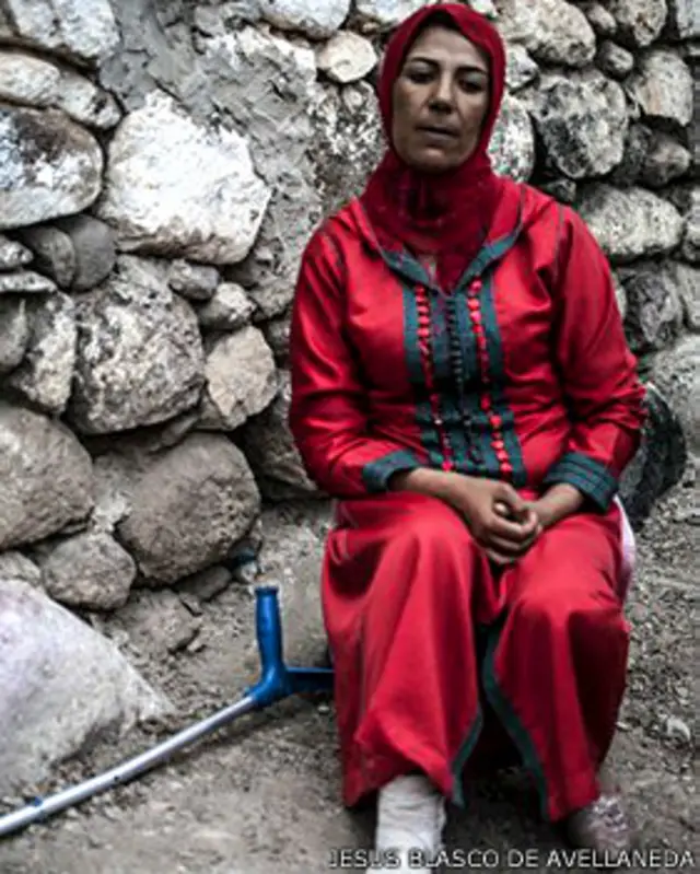 أصيبت ماريا في ساقها أكثر من مرة جراء العمل كبورتيدورا