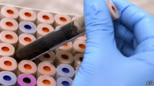 Exame de sangue (AP)