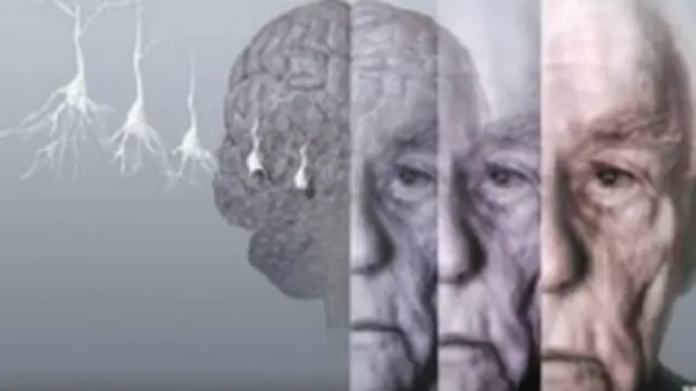 डिमेंशिया, मनोभ्रंश