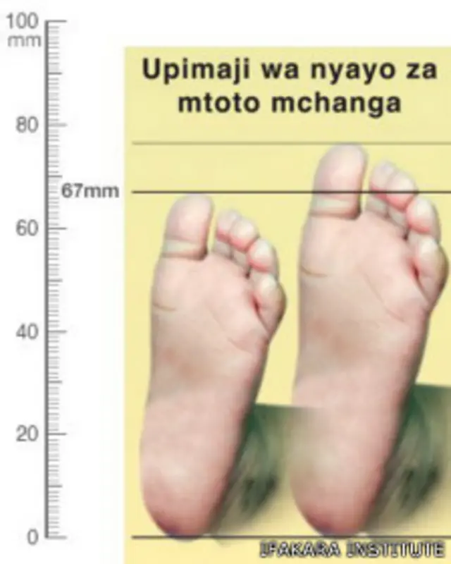 Plantilla para medir el pie del recién nacido