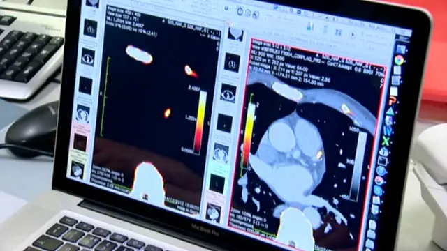 عام طور پر ڈاکٹر دل کے دورے کے معاملے میں خون کی جانچ پر بھروسہ کرتے ہیں
