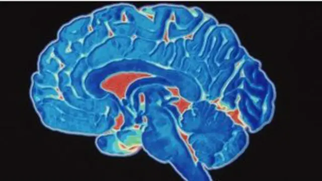 سيتمكن الأطباء من اكتشاف مرض الزهايمر من خلال فحص العيون