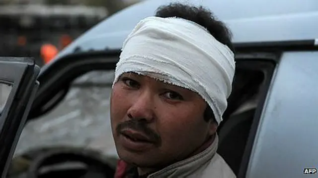 اس حملے میں 20 سے زیادہ افراد زخمی ہوئے ہیں