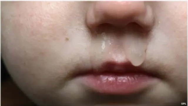 बहती नाक