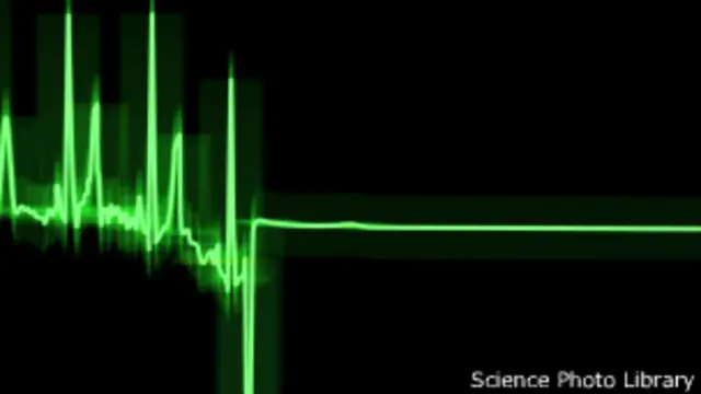 Heartbeat, Science Photo Library