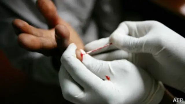 استخدام مضادات الإيدز