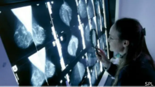 الكوليسترول يزيد من مخاطر سرطان الثدي