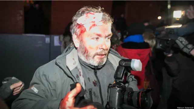 Під час сутички з "Беркутом" отримав поранення фотограф Reuters Гліб Гаранич, який працював на Майдані.