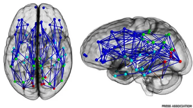 ब्रेन मैपिंग