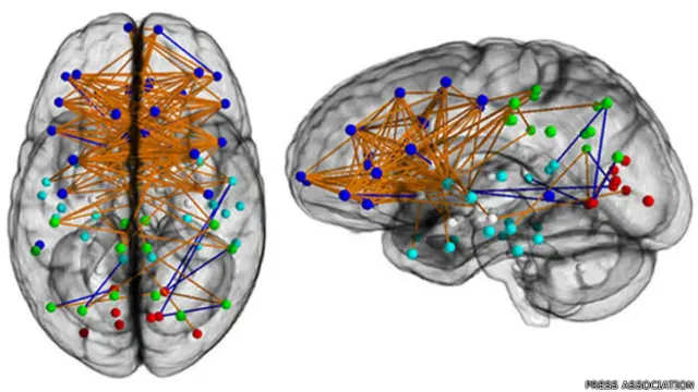 पुरुषों के मस्तिष्क का हेमीस्फियर बाहर से जबकि महिलाओं में यह अंदर से ज्यादा जुड़ा होता है.