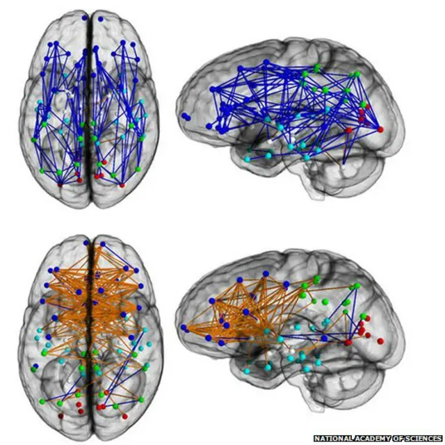 نیلا دماغ (اوپر والی دو تصاویر) مرد کا ہے جب کہ نیچے نارنجی سرکٹوں والا دماغ عورت کا ہے