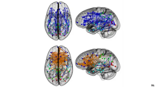 Cérebros masculino e feminino | Foto: PA