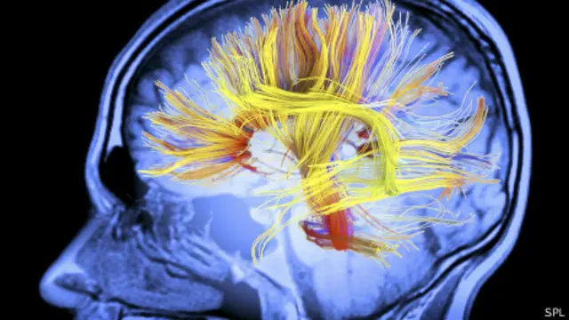 Conexiones en cerebro humano