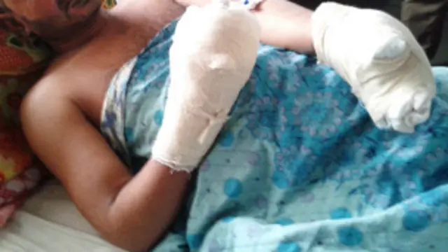 سیمه کې له دې مخکې هم د اورلګېدنې پېښې رامنځ ته شوې.