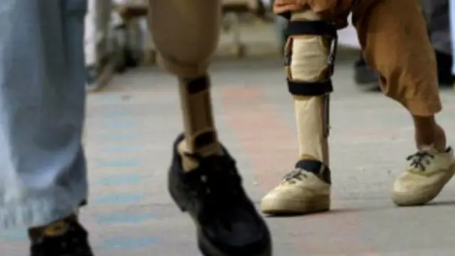 ماضی میں پولیو سے ہر سال ساڑھے تین لاکھ لوگ معذور ہو جاتے تھے