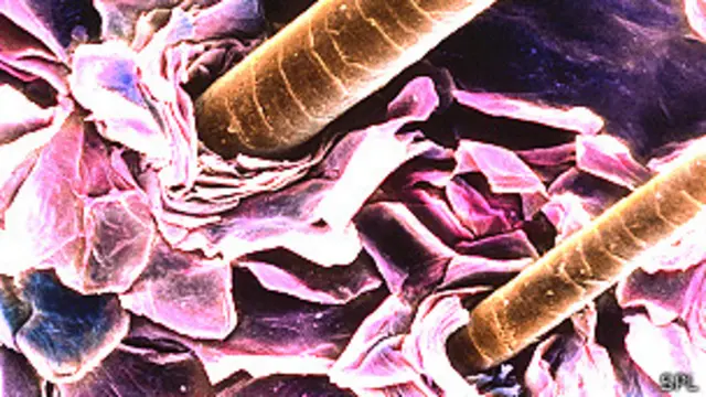 Pelos en el cuero cabelludo en una imagen tomada con un microscopio de electrones