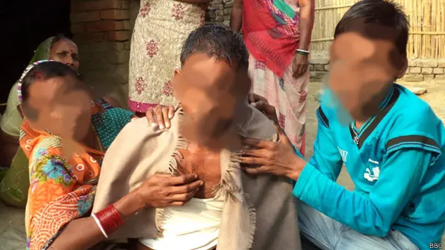 एड्सपीड़ित