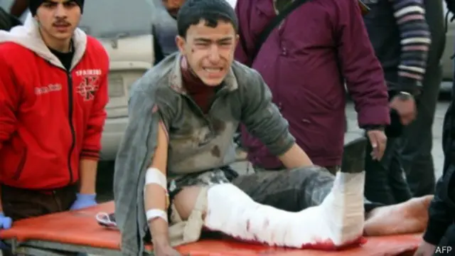 زخمی های حلب