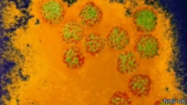 ویروس پاپیلومای انسانی عامل ایجاد بیماری زگیل تناسلی در انسان است