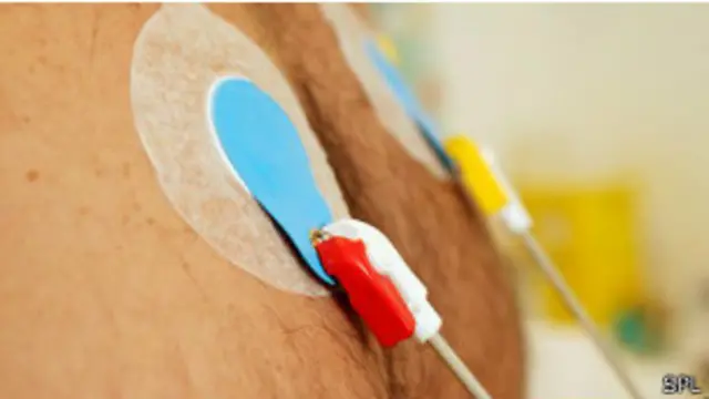 څارونکي وايي د ورځې د پنځو کسانو غوسه په ۱۰ زرو کسانو کې پر ۱۵۸ کسانو د زړه د حملې چانسونه ډېروي.