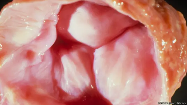 मानव हृदय