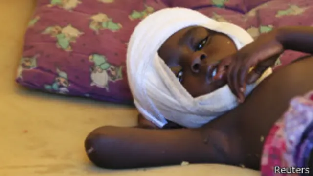 朱巴国际机场的一位受伤儿童（24/12/2013）