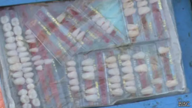 सड़क छाप दंत चिकित्सक