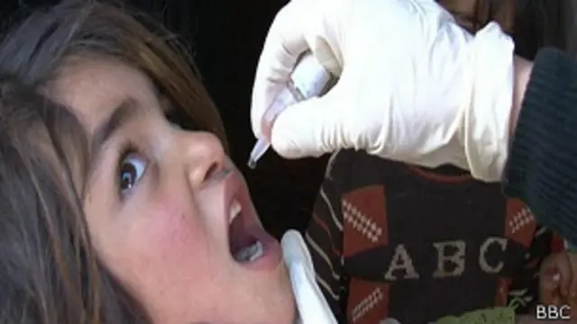 پولیو وائرس پاکستان سے دیگر ممالک تک بھی پھیلا