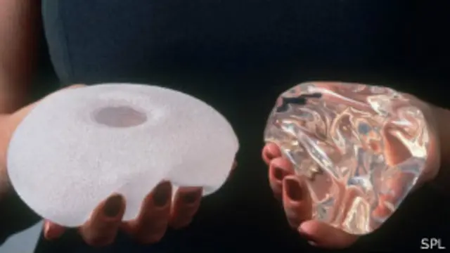 قال وزير الصحة البريطاني "إن فضيحة عمليات زراعة الثدي ألقت الضوء على صناعة يشوبها الكثير من الممارسات الضبابية"