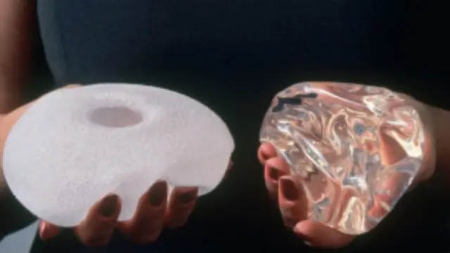 英国去年整容手术数量急剧上升,最受欢迎的是隆胸和抽脂等。