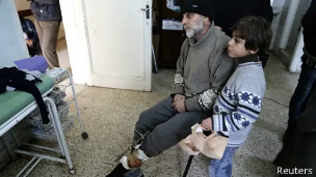 طفل في مستشفى بحلب