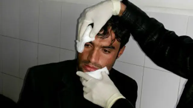 زلمی حليمي ادعا کوي چې تر وهلو وړاندې ورته ګواښونه شوي دي