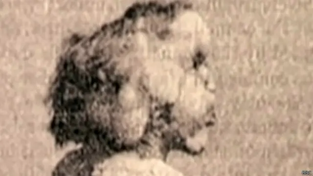 Joseph Merrick | Crédito: BBC