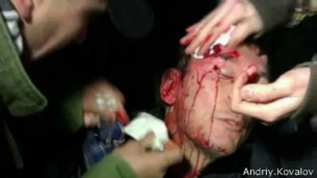 У Юрия Луценко - сотрясение мозга и черепно-мозговая травма