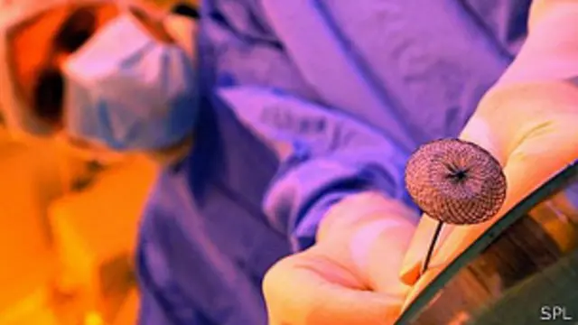 Procedimiento quirúrgico 