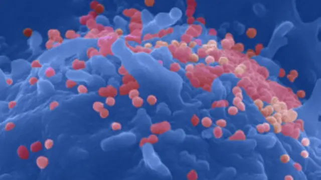 显微镜下的HIV病毒颗粒