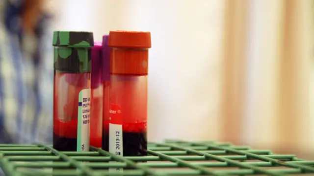 Os testes sanguíneos de Bowes mostraram níveis mais baixos de um agente associado ao envelhecimento