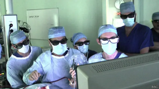 Operación del cerebro en 3D