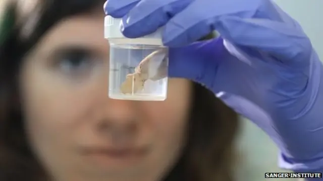 Células de un tumor cancerígeno en un laboratorio