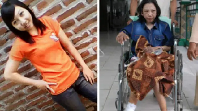 被虐打的印尼佣工厄维阿纳的两张资料照片