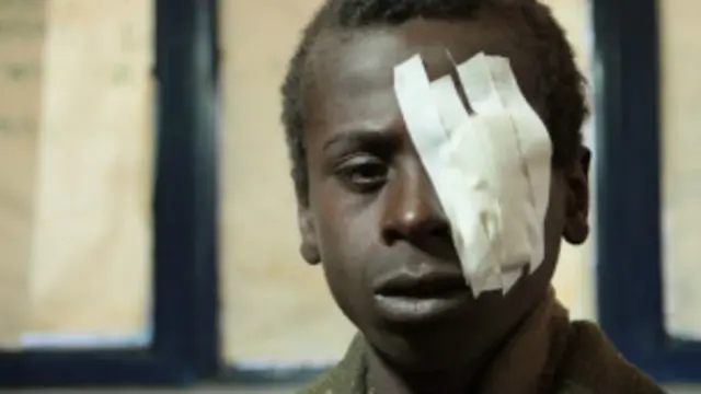 تبدأ الإصابة بهذا المرض في مرحلة الطفولة.