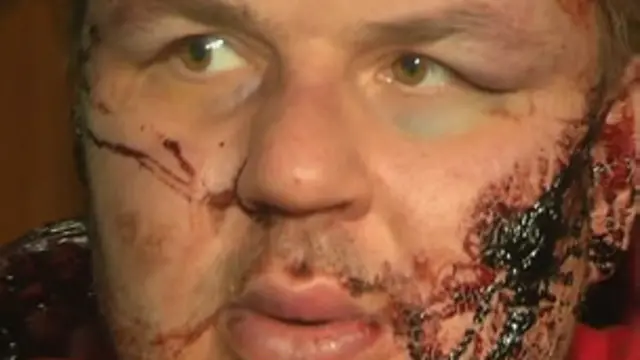 ضرب و جرح شدید دیمیتری بولاتوف خیلی ها را در اوکراین خشمگین کرده است