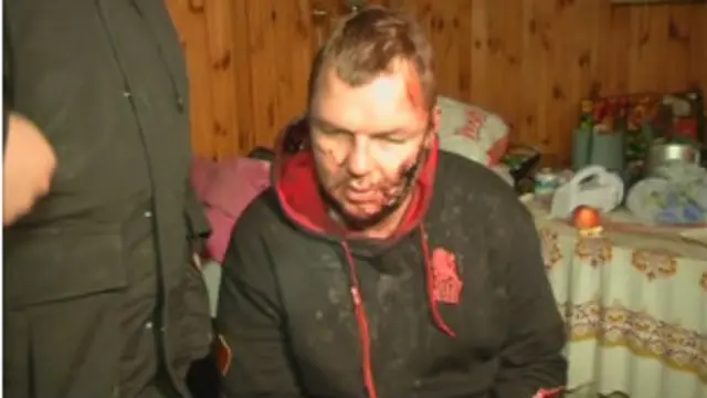 دیمتری بولاتو گذشتہ ہفتے ٹیلی وژن پر دکھائے دیے تھے جہاں ان کے چہرے پر زخمی کے نشان اور کٹا ہوا کان دیکھا جاسکتا تھا