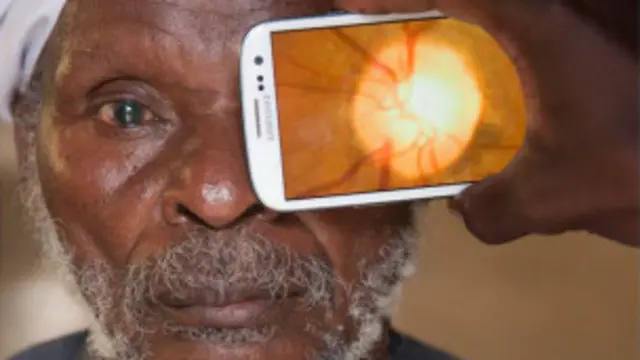 The phone can be used to look at the retina at the back of the eye and check the health of the optic nerve