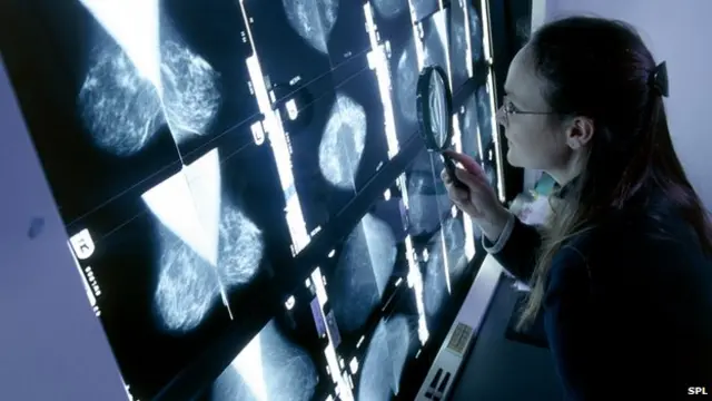 ہر سال ایک کروڑ 40 لاکھ افراد سرطان میں مبتلا ہوتے ہیں