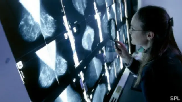 حذرت منظمة الصحة العالمية من "ارتفاع شديد" في معدلات الإصابة بمرض السرطان.