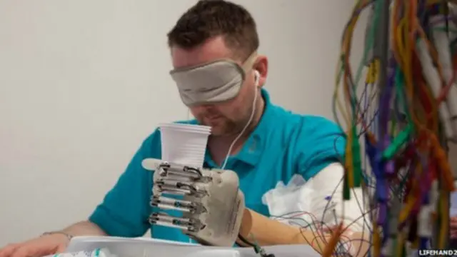 bionic hand