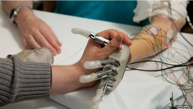 कृत्रिम हाथ